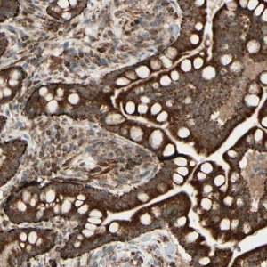 Anti-DHRS3 antibody produced in rabbit 