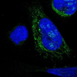 Anti-DHRS3 antibody produced in rabbit 
