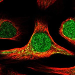Anti-DHRS7 antibody produced in rabbit 
