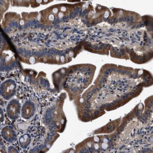 Anti-DHRS7B antibody produced in rabbit 