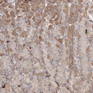Anti-DHRS9 antibody produced in rabbit HPA036667-100UL