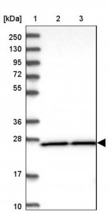 Anti-DHRS9 antibody produced in rabbit HPA036667-100UL