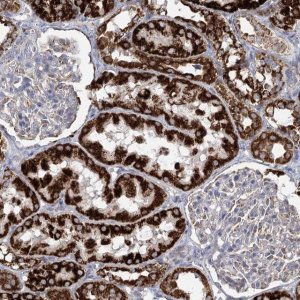 Anti-DHTKD1 antibody produced in rabbit 