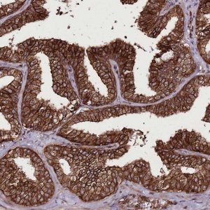 Anti-DHX29 antibody produced in rabbit HPA038317-100UL