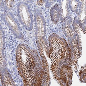 Anti-DHX34 antibody produced in rabbit 