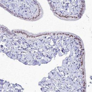 Anti-DHX40 antibody produced in rabbit HPA044350-100UL