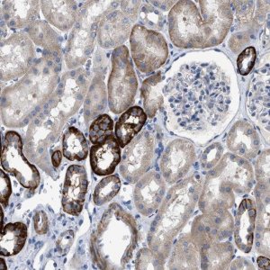 Anti-DHX58 antibody produced in rabbit 