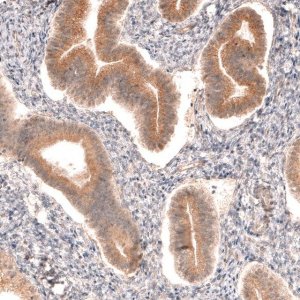 Anti-DICER1 antibody produced in rabbit 