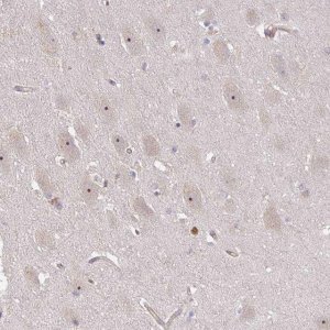 Anti-DIMT1 antibody produced in rabbit 