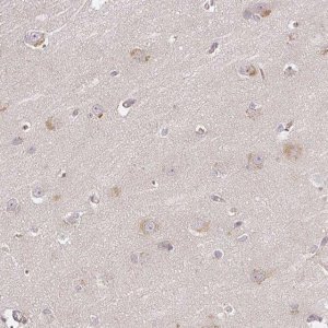 Anti-DIMT1 antibody produced in rabbit 