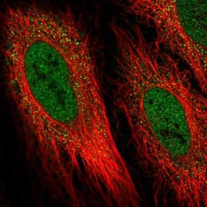 Anti-DIO2 antibody produced in rabbit 