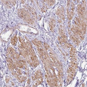 Anti-DIP2A antibody produced in rabbit 