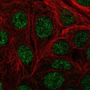 Anti-DIP2A antibody produced in rabbit 