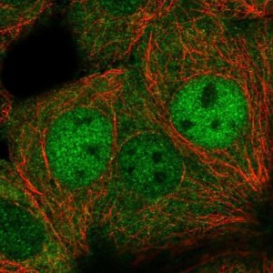 Anti-DIP2C antibody produced in rabbit 