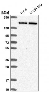Anti-DIP2C antibody produced in rabbit 