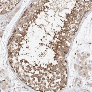 Anti-DIRAS3 antibody produced in rabbit 