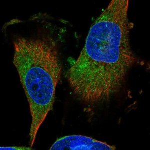 Anti-DIRAS3 antibody produced in rabbit 