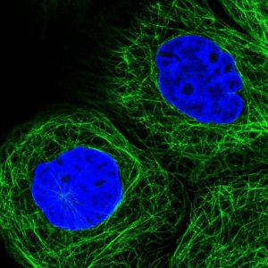 Anti-SLC24A1 antibody produced in rabbit 