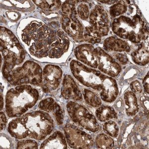 Anti-SLC25A10 antibody produced in rabbit 