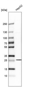Anti-SLC25A10 antibody produced in rabbit 
