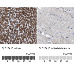Anti-SLC25A13 antibody produced in rabbit 