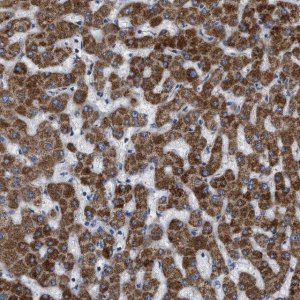 Anti-SLC25A13 antibody produced in rabbit 