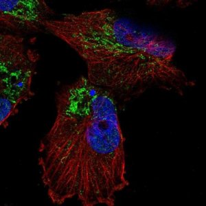 Anti-SLC25A14 antibody produced in rabbit 
