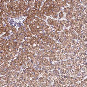 Anti-SLC25A15 antibody produced in rabbit 