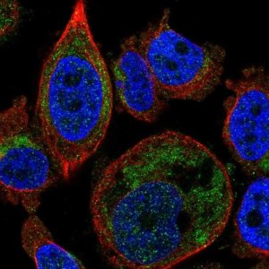 Anti-SLC25A16 antibody produced in rabbit 