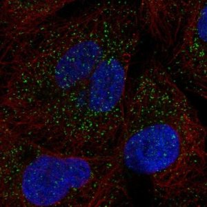 Anti-SLC25A17 antibody produced in rabbit 