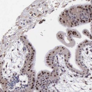 Anti-SLC25A21 antibody produced in rabbit 
