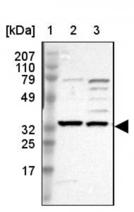 Anti-SLC25A21 antibody produced in rabbit 