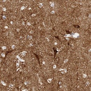 Anti-SLC25A22 antibody produced in rabbit 