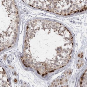 Anti-SLC25A22 antibody produced in rabbit 