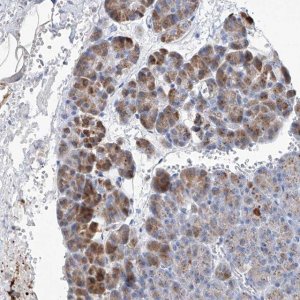 Anti-SLC25A29 antibody produced in rabbit 