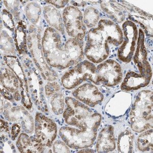 Anti-SLC25A31 antibody produced in rabbit 