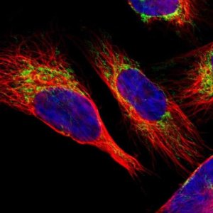 Anti-SLC25A31 antibody produced in rabbit 