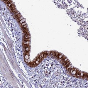 Anti-SLC25A37 antibody produced in rabbit 
