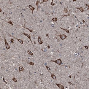 Anti-SLC25A38 antibody produced in rabbit 