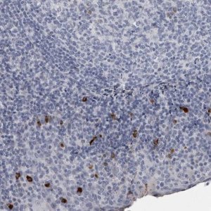 Anti-SLC25A39 antibody produced in rabbit 