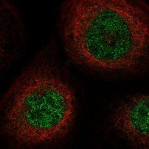 Anti-SLC25A43 antibody produced in rabbit 