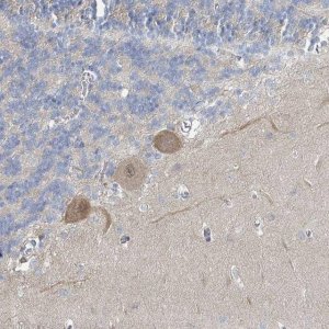 Anti-SLC25A45 antibody produced in rabbit 