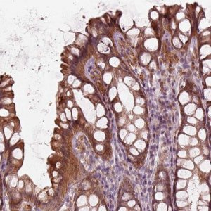 Anti-SLC25A46 antibody produced in rabbit HPA071582-100UL