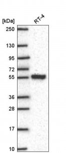 Anti-SLC25A46 antibody produced in rabbit HPA071582-100UL
