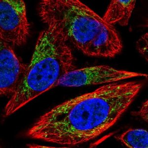 Anti-SLC25A5 antibody produced in rabbit HPA046835-100UL
