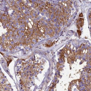 Anti-SLC26A10 antibody produced in rabbit 