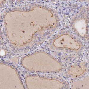 Anti-SLC26A4 antibody produced in rabbit 