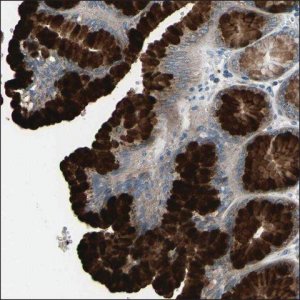 Anti-SLC27A1 antibody produced in rabbit HPA008255-100UL