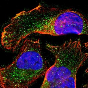 Anti-SLC27A4 antibody produced in rabbit 