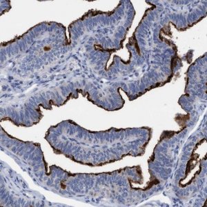Anti-SLC28A3 antibody produced in rabbit 